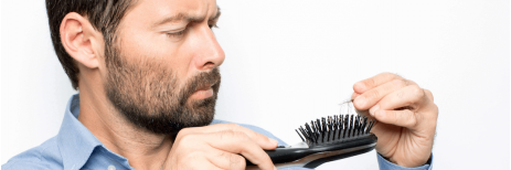 تساقط الشعر عند الرجال أسبابه وطرق علاجه 